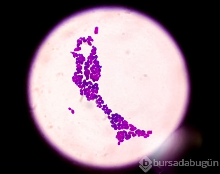 Yeni ölümcül salgın: Candida auris