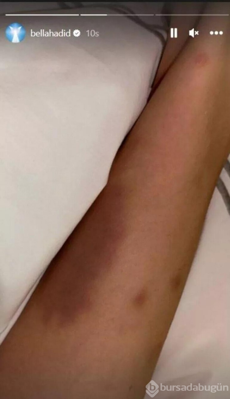 Bella Hadid bikinili pozlarını paylaştı! Bir yorum dikkat çekti