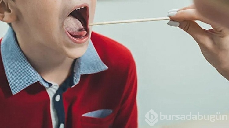 Strep A hastalığı nedir, belirtileri nelerdir?
