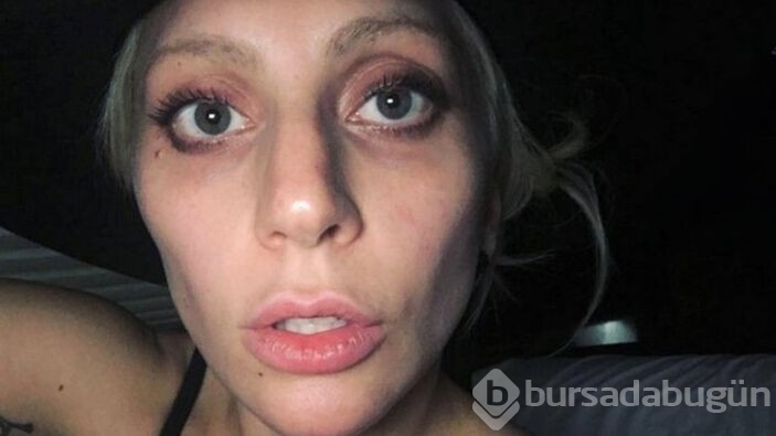 Ünlü şarkıcı Lady Gaga'nın köpek davası devam ediyor
