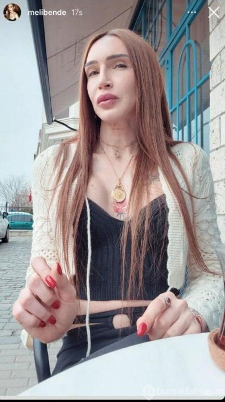Cinsiyet değiştiren Ahmet Melih Yılmaz'ın pozları sosyal medyayı salladı!