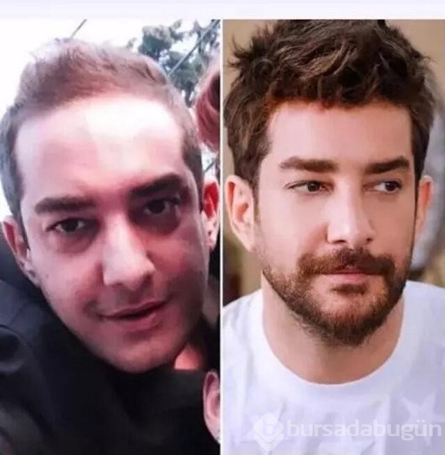 Oyuncu Enis Arıkan'ın eski halini görenler şok oldu!