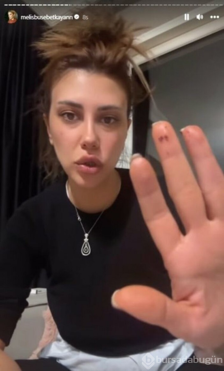 Buse Melis Betkayan kendisini darbeden sevgilisi ile barıştı