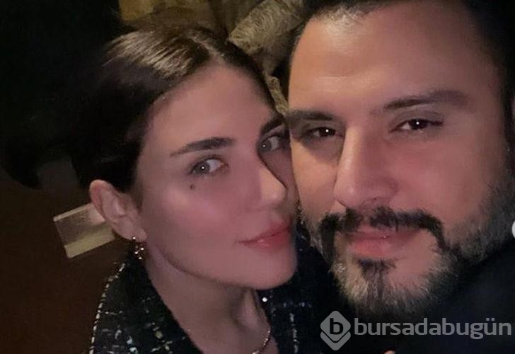 Buse Varol'un dudak dolgusu gözlerden kaçmadı! 