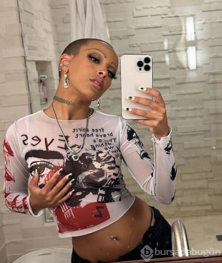 Göğüs küçültme ameliyatı olan Doja Cat açıklamalarıyla şok etti