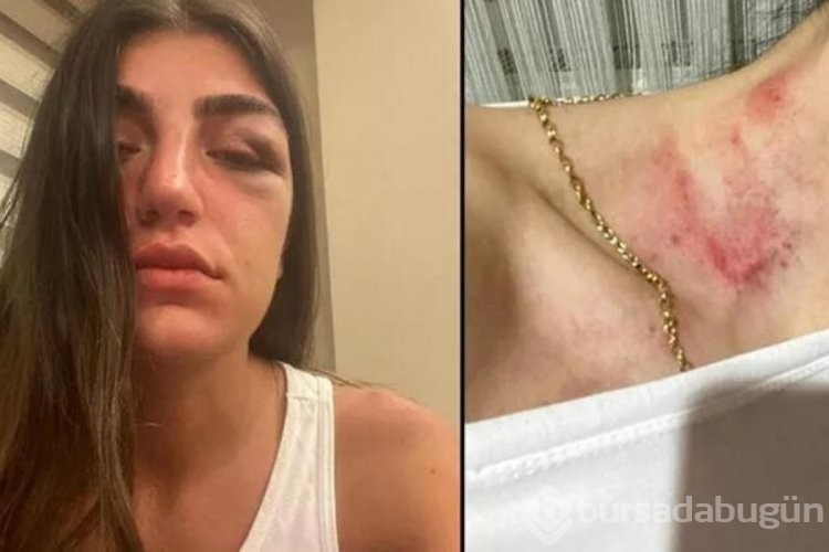 Manken Gizem Akbaş'ı darbeden eski sevgiliye verilen ceza: 6 yıl Hapis