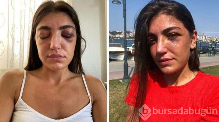 Manken Gizem Akbaş'ı darbeden eski sevgiliye verilen ceza: 6 yıl Hapis
