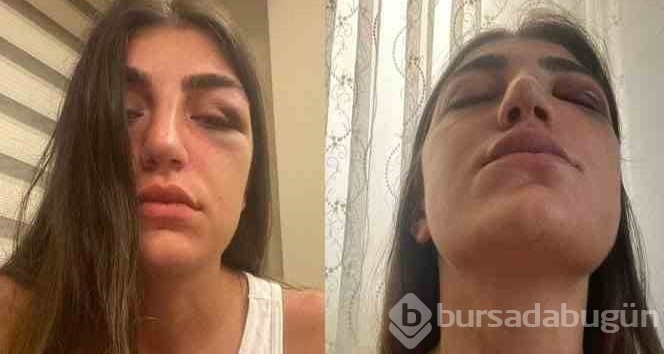 Manken Gizem Akbaş'ı darbeden eski sevgiliye verilen ceza: 6 yıl Hapis