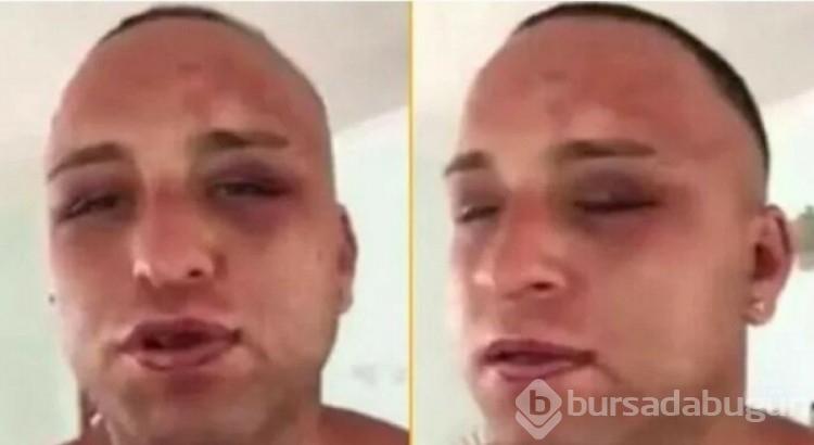 Survivor eski yarışmacısı Taner Tolga Tarlacı'yı cezaevinde komalık ettiler!