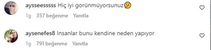 Ünlü sunucu Özge Ulusoy estetiğin dozunu kaçırdı