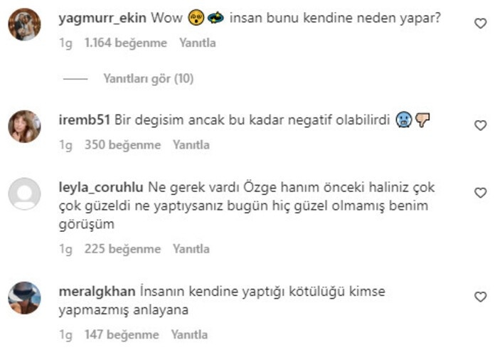 Ünlü sunucu Özge Ulusoy estetiğin dozunu kaçırdı