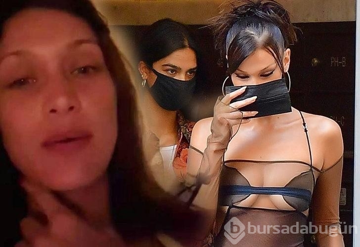 Bella Hadid: Her gün tedavisi olmayan acılar çekiyorum