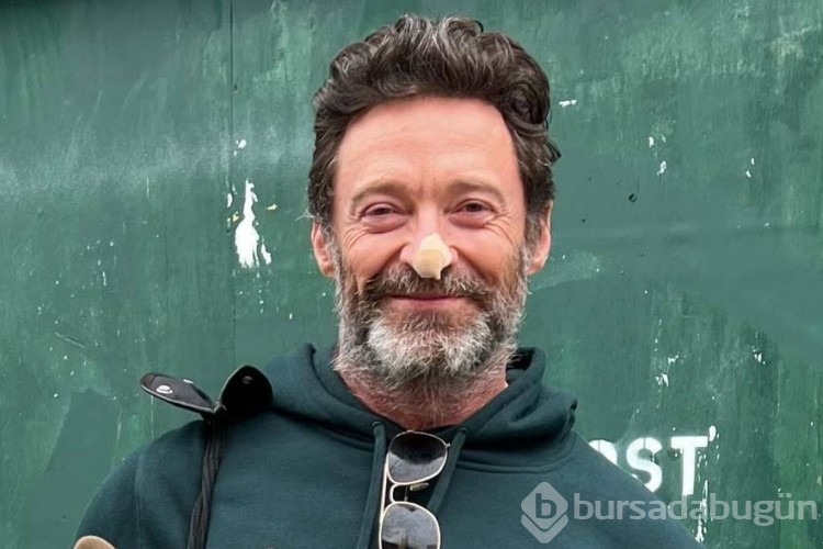 Jackman biyopsi sonucunu açıkladı