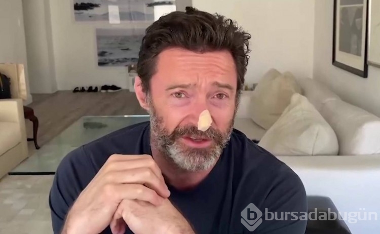 Jackman biyopsi sonucunu açıkladı