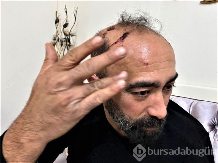Ceza yağdı! Taksi şoförünün başına taşla vurmuştu! 