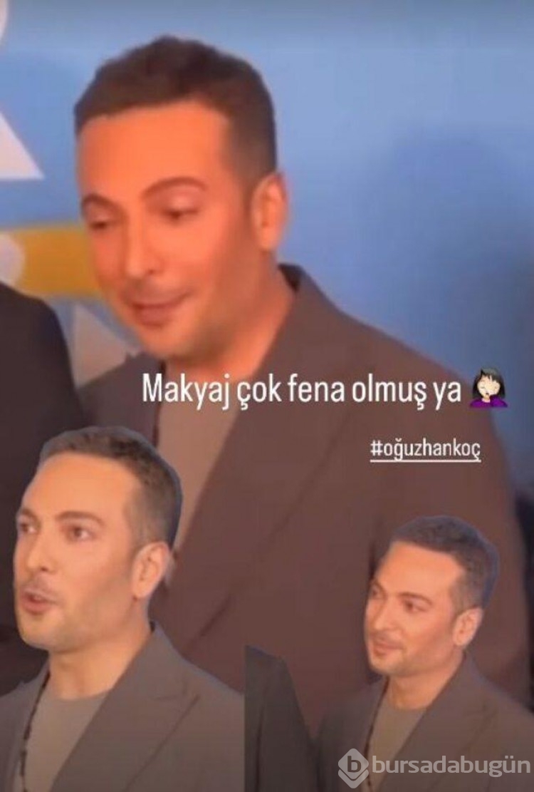 Oğuzhan Koç'un yüzünün hali sosyal medyada gündem oldu