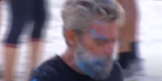 Survivor'da Murat Eken başından yaralanıp kanlar içinde kaldı