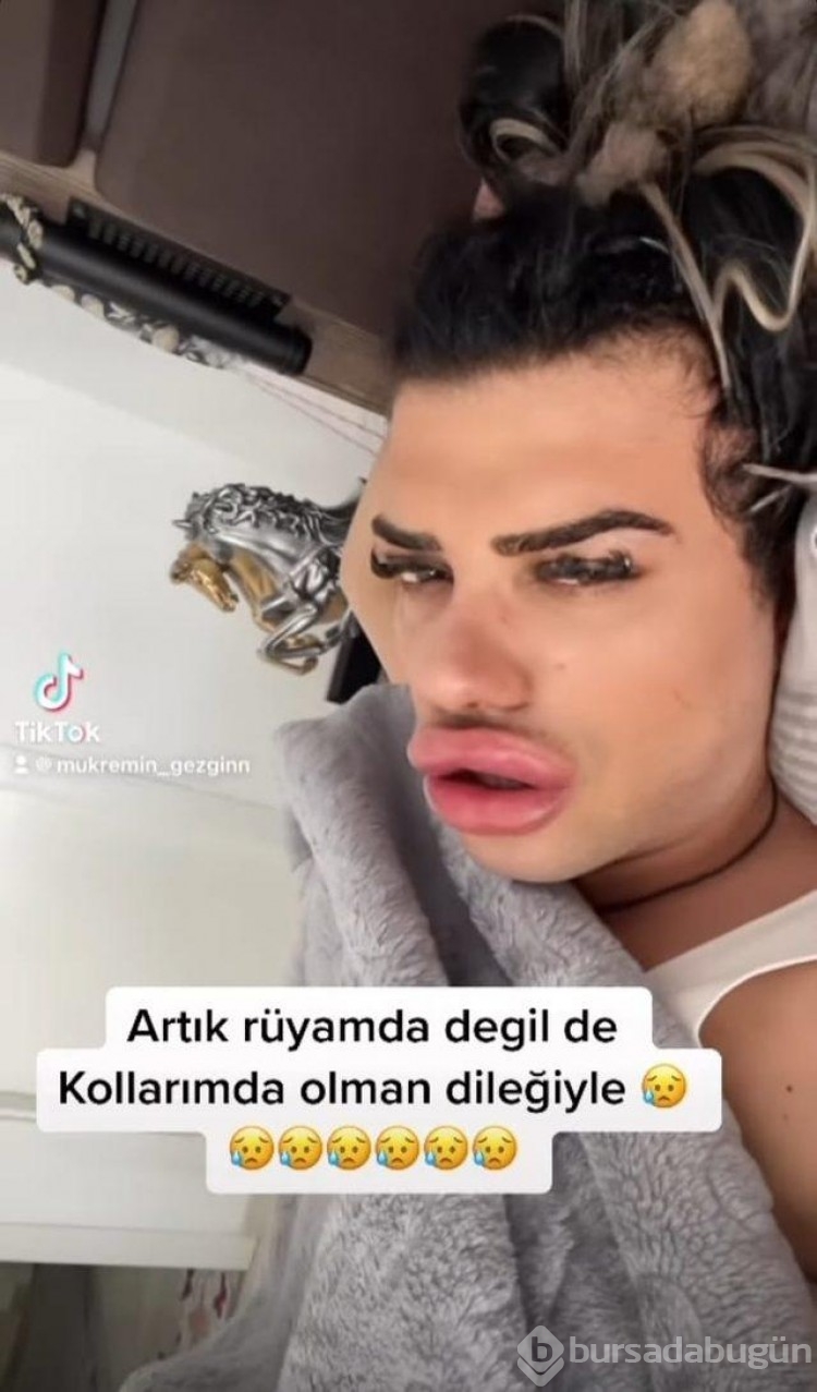 Bebek senaryosu ile gündem olan TikTokçu Mükremin Gezgin estetik oldu!