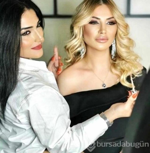 Songül Karlı yeni estetikleriyle Hadise'ye benzetildi