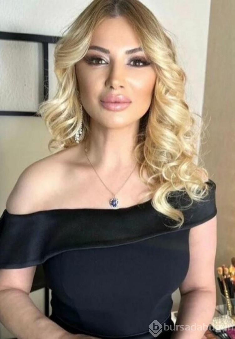 Songül Karlı yeni estetikleriyle Hadise'ye benzetildi