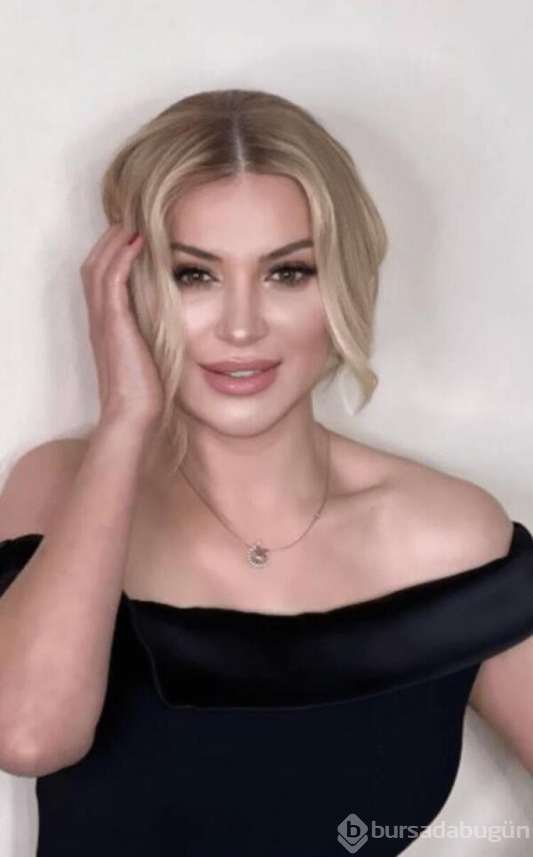 Songül Karlı yeni estetikleriyle Hadise'ye benzetildi