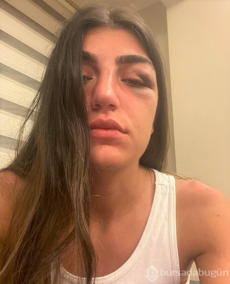 Gizem Akbaş'ı darp eden sanığın cezası belli oldu
