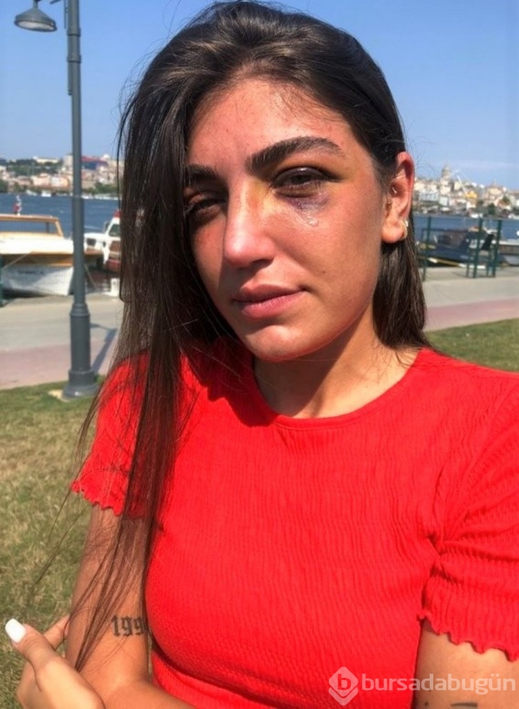 Gizem Akbaş'ı darp eden sanığın cezası belli oldu
