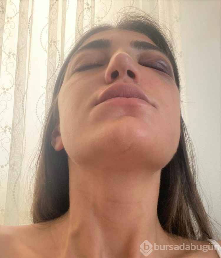 Gizem Akbaş'ı darp eden sanığın cezası belli oldu
