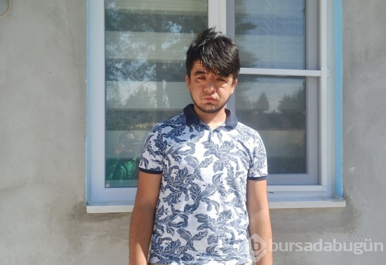 20 yaşındaki Enes'in nadir hastalığı: Görenler 40 yaşında sanıyor!