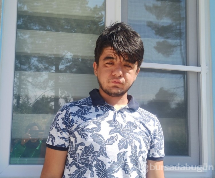 20 yaşındaki Enes'in nadir hastalığı: Görenler 40 yaşında sanıyor!
