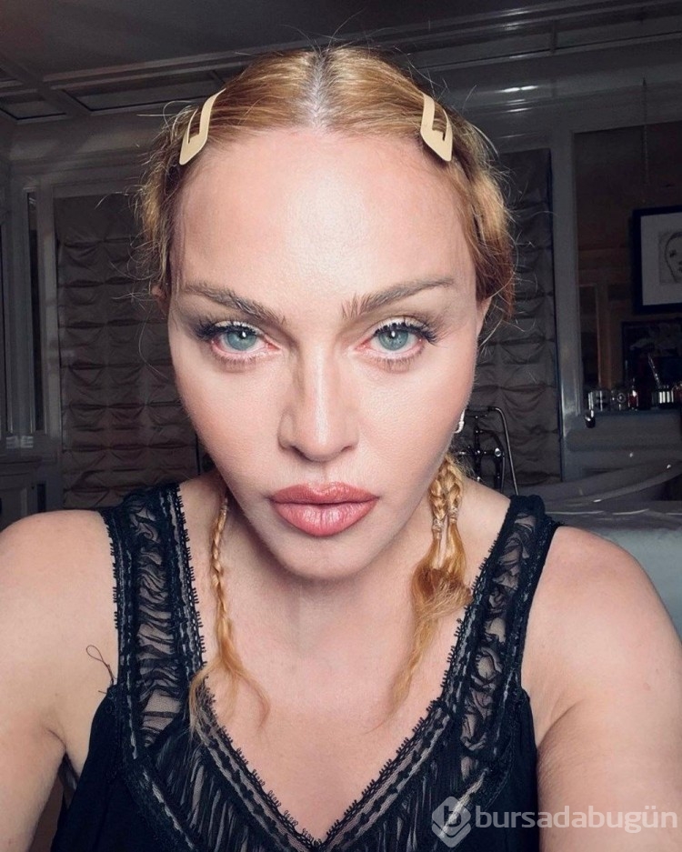 Entübe edilmişti! Madonna tedavi sonrası ilk kez görüntülendi