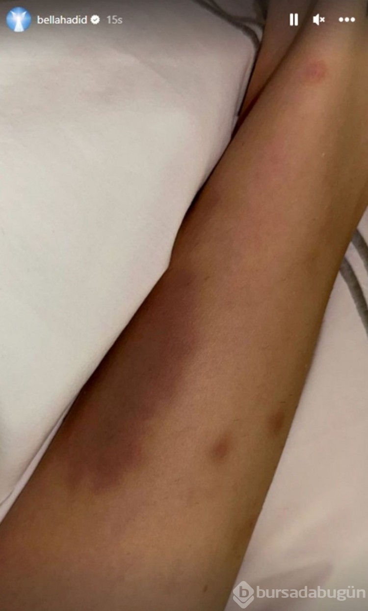 Bella Hadid sosyal medyaya geri döndü
