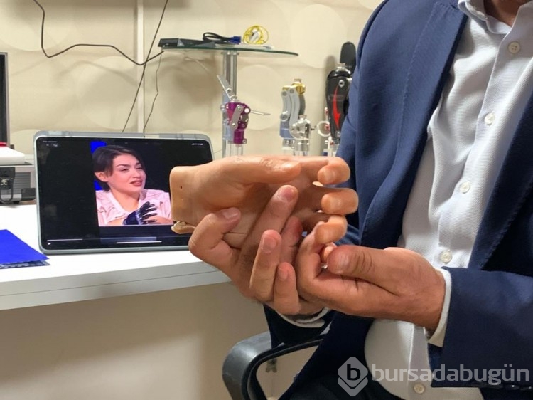 Yarışma programında 1 milyon lira kazanan Rabia'ya müjde!  Protezini iş adamı karşılayacak