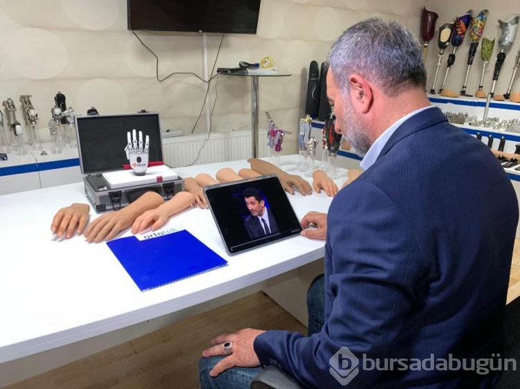 Yarışma programında 1 milyon lira kazanan Rabia'ya müjde!  Protezini iş adamı karşılayacak
