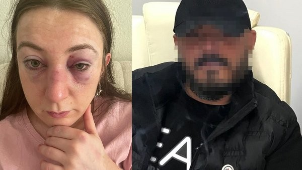 Bursa'da eski sevgilisini dövüp, ölümle tehdit eden şahıs yakalandı