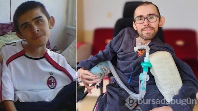 3 yaşında düştü gerçek çok başka çıktı!