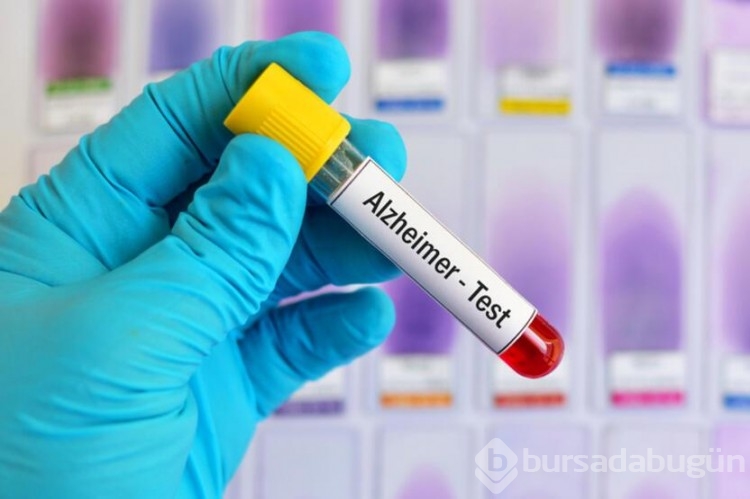 "İlk önemli ipucu": Alzheimer hastalarında beyin hücrelerinin neden öldüğü keşfedildi