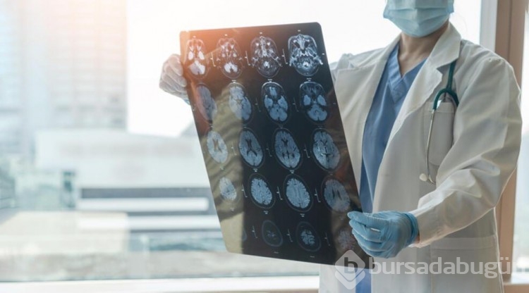 "İlk önemli ipucu": Alzheimer hastalarında beyin hücrelerinin neden öldüğü keşfedildi