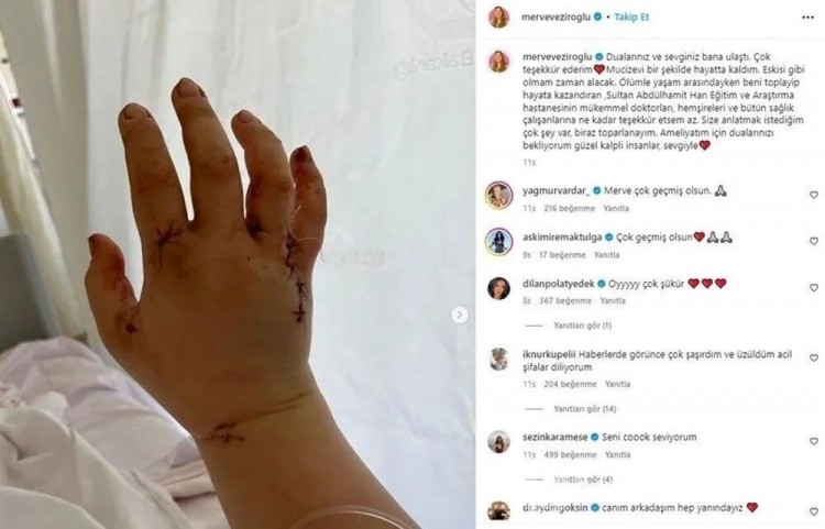 Eşi tarafından 32 kez bıçaklanan YouTuber Merve Veziroğlu yaşadıklarını anlattı: Çok yalvardım, 'öleceksin' dedi