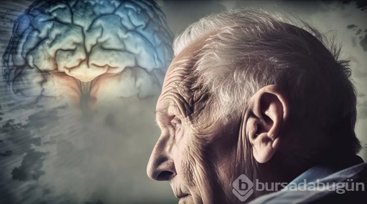 Dünyada her 3,2 saniyede bir kişi Alzheimer hastalığına yakalanıyor