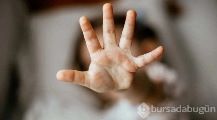 Cinsel suç mağduru çocuk sayısında korkutan artış! Son 9 yılda 3 katına çıktı