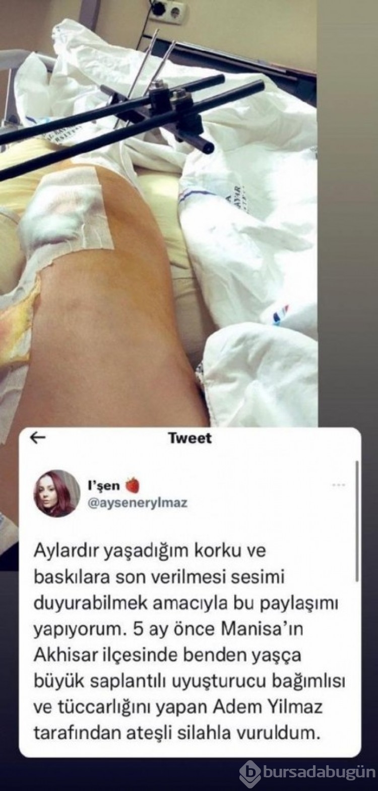 Manisa'da ayrılmak istedi, dizinden vuruldu!