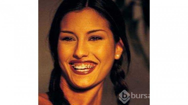 Bergüzar Korel'in ergenlik fotoğrafı şaşırttı