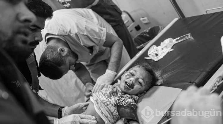 Gazze'deki yaralı siviller Naseer Hastanesi'nde yaşam savaşı veriyor