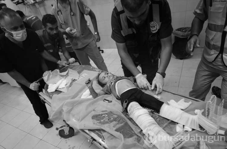 Gazze'deki yaralı siviller Naseer Hastanesi'nde yaşam savaşı veriyor