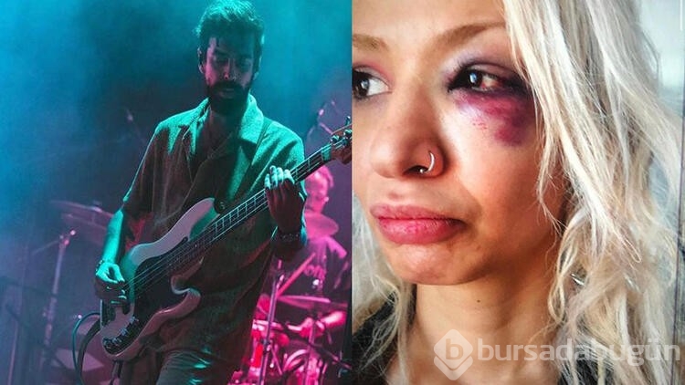 Yüzyüzeyken Konuşuruz'un gitaristine sevgilisini darbettiği iddiasıyla soruşturma 
