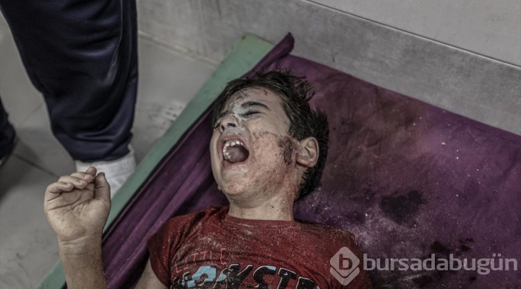 Gazze'de hastaneler acı ve gözyaşıyla dolu...
