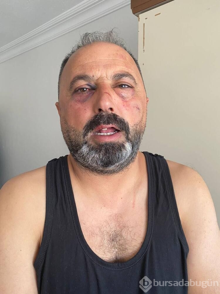 Baba ve oğula 'Ne bakıyorsun' dayağı
