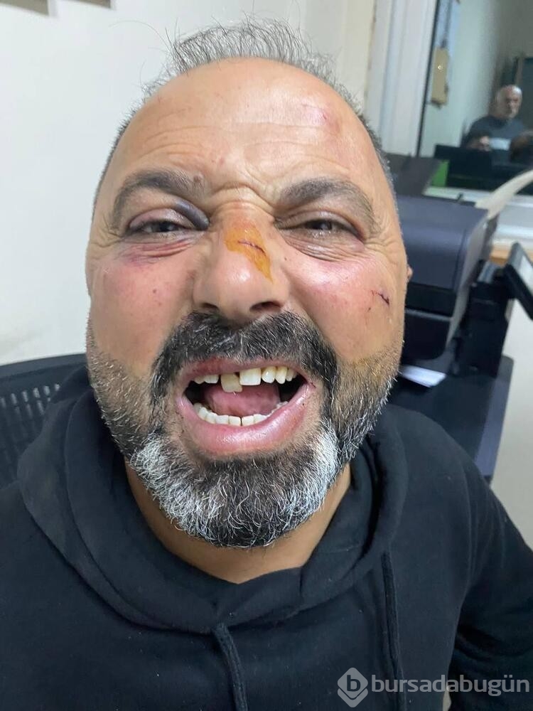 Baba ve oğula 'Ne bakıyorsun' dayağı

