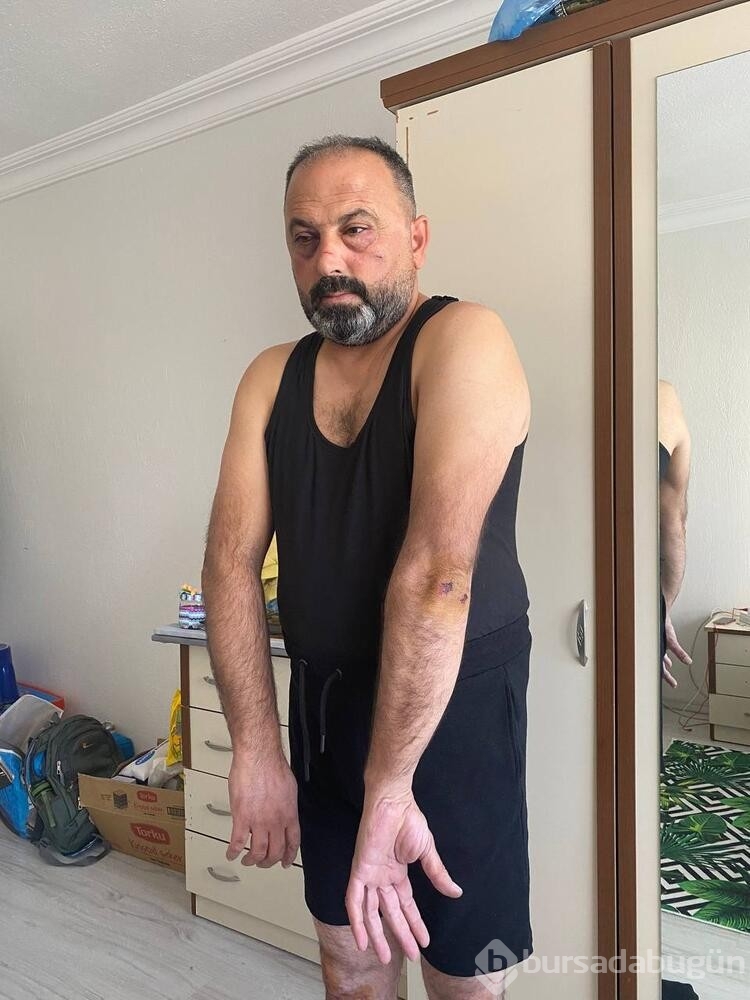 Baba ve oğula 'Ne bakıyorsun' dayağı
